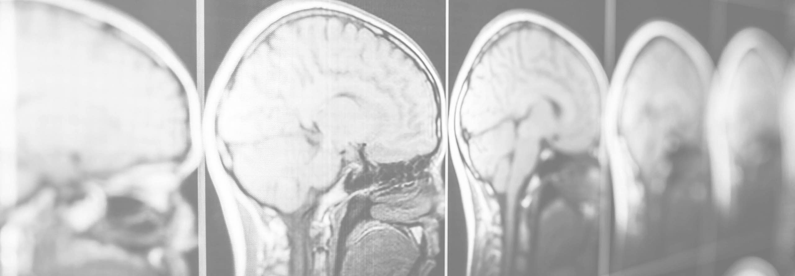 Serious Personal Injury Bowman Jarashow Law